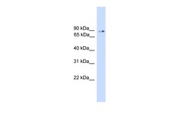 Aviva Systems Biology Corp PIK3R5 Antibody - middle region (ARP55012_P050)