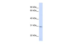 Aviva Systems Biology Corp SMUG1 Antibody - middle region (ARP55013_P050)