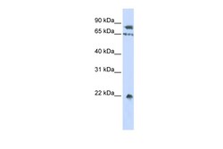 Aviva Systems Biology Corp SENP1 Antibody - middle region (ARP55082_P050)