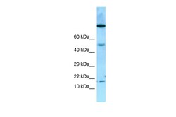 Aviva Systems Biology Corp OBP2A Antibody - middle region (ARP55085_P050)