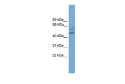 Aviva Systems Biology Corp RAB11FIP2 Antibody - N-terminal region (ARP55095_P050)