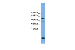Aviva Systems Biology Corp PPP6R1 Antibody - N-terminal region (ARP55109_P050)