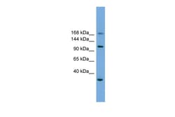 Aviva Systems Biology Corp PHLDB1 Antibody - middle region (ARP55186_P050)