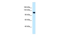 Aviva Systems Biology Corp Anks1 Antibody - C-terminal region (ARP55208_P050)