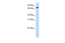 Aviva Systems Biology Corp COG4 Antibody - middle region (ARP55242_P050)