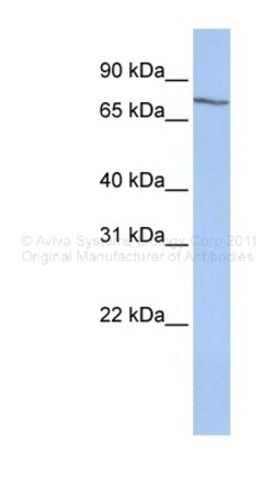 Aviva Systems Biology Corp SAMHD1 Antibody - middle region (ARP55262_P050)