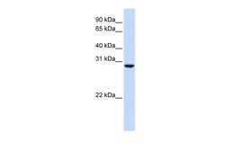 Aviva Systems Biology Corp C18orf10 Antibody - middle region (ARP55267_P050)