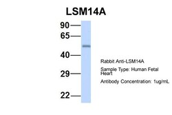 Aviva Systems Biology Corp LSM14A Antibody - C-terminal region (ARP55289_P050)