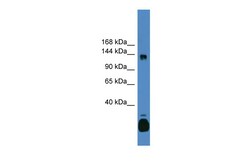Aviva Systems Biology Corp C10orf12 Antibody - C-terminal region (ARP55319_P050)