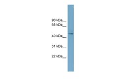 Aviva Systems Biology Corp EFEMP2 Antibody - middle region (ARP55351_P050)