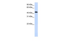Aviva Systems Biology Corp MKNK2 Antibody - N-terminal region (ARP55352_P050)