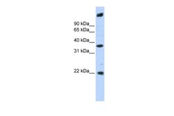 Aviva Systems Biology Corp SSBP3 Antibody - middle region (ARP55354_P050)