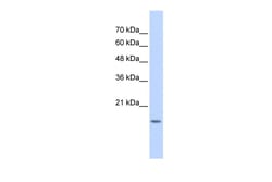 Aviva Systems Biology Corp GABARAPL1 Antibody - middle region (ARP55399_P050)