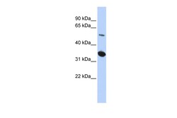 Aviva Systems Biology Corp ABRAXAS2 Antibody - middle region (ARP55402_P050)