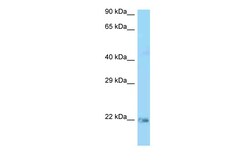 Aviva Systems Biology Corp Kras Antibody - N-terminal region (ARP55409_P050)