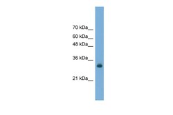 Aviva Systems Biology Corp FAM78A Antibody - C-terminal region (ARP55411_P050)