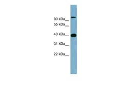 Aviva Systems Biology Corp CCNDBP1 Antibody - middle region (ARP55414_P050)