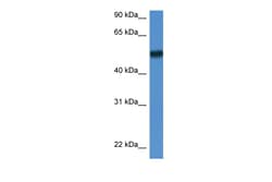 Aviva Systems Biology Corp Bin1 Antibody - N-terminal region (ARP55436_P050)