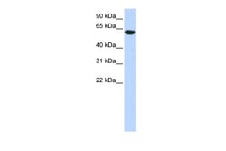 Aviva Systems Biology Corp CFAP53 Antibody - N-terminal region (ARP55454_P050)