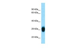 Aviva Systems Biology Corp Ska1 Antibody - middle region (ARP55460_P050)