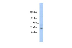 Aviva Systems Biology Corp C9orf25 Antibody - middle region (ARP55478_P050)