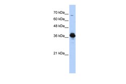 Aviva Systems Biology Corp ATP6V0D2 Antibody - middle region (ARP55487_P050)