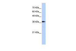 Aviva Systems Biology Corp ATP6V0D2 Antibody - middle region (ARP55488_P050)