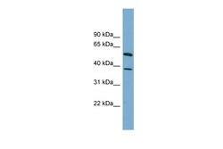 Aviva Systems Biology Corp HEPACAM Antibody - N-terminal region (ARP55504_P050)