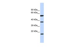 Aviva Systems Biology Corp NT5DC1 Antibody - N-terminal region (ARP55511_P050)