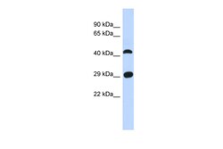 Aviva Systems Biology Corp CFAP299 Antibody - N-terminal region (ARP55538_P050)