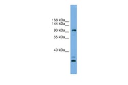 Aviva Systems Biology Corp CCDC110 Antibody - middle region (ARP55544_P050)