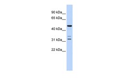 Aviva Systems Biology Corp HTRA4 Antibody - middle region (ARP55603_P050)
