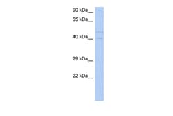 Aviva Systems Biology Corp SGK3 Antibody - N-terminal region (ARP55612_P050)