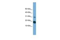 Aviva Systems Biology Corp IL1F5 Antibody - middle region (ARP55628_P050)