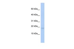 Aviva Systems Biology Corp RFESD Antibody - middle region (ARP55631_P050)