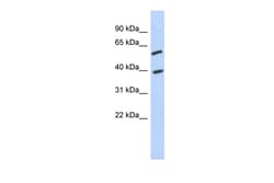 Aviva Systems Biology Corp C6orf146 Antibody - middle region (ARP55647_P050)