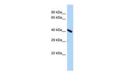 Aviva Systems Biology Corp Endov Antibody - middle region (ARP55675_P050)