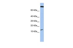 Aviva Systems Biology Corp FLJ37543 Antibody - middle region (ARP55684_P050)