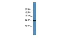 Aviva Systems Biology Corp SFRS12IP1 Antibody - N-terminal region (ARP55718_P050)