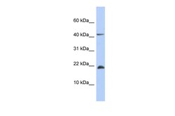 Aviva Systems Biology Corp SFRS12IP1 Antibody - middle region (ARP55719_P050)
