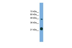 Aviva Systems Biology Corp RAB37 Antibody - middle region (ARP55738_P050)