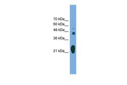 Aviva Systems Biology Corp RAB37 Antibody - middle region (ARP55739_P050)