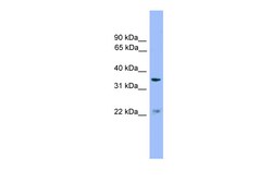 Aviva Systems Biology Corp ZDHHC21 Antibody - middle region (ARP55783_P050)