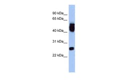 Aviva Systems Biology Corp ERAS Antibody - middle region (ARP55794_P050)