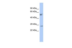Aviva Systems Biology Corp RD3 Antibody - N-terminal region (ARP55856_P050)