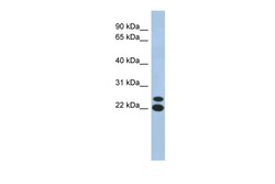 Aviva Systems Biology Corp C19orf54 Antibody - N-terminal region (ARP55875_P050)
