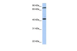 Aviva Systems Biology Corp TEX9 Antibody - middle region (ARP55896_P050)