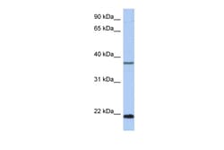 Aviva Systems Biology Corp HDDC3 Antibody - middle region (ARP55898_P050)