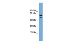 Aviva Systems Biology Corp TEX45 Antibody - middle region (ARP55899_P050)