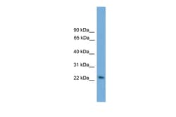Aviva Systems Biology Corp RAB15 Antibody - middle region (ARP55918_P050)
